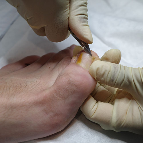 Medico Podologo in centro a Milano