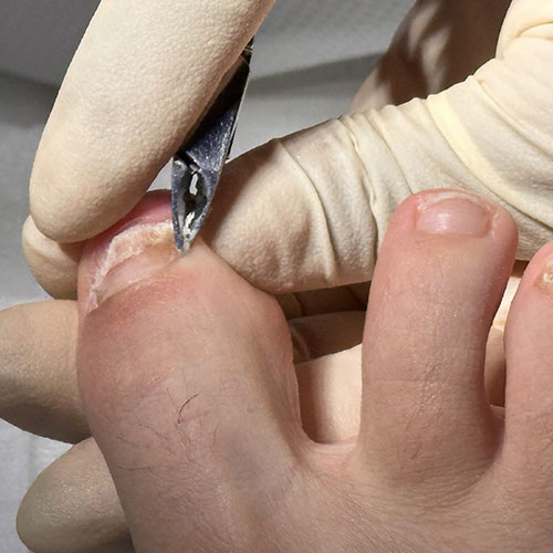 Medico Podologo in centro a Milano