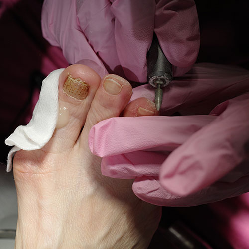 Medico Podologo in centro a Milano